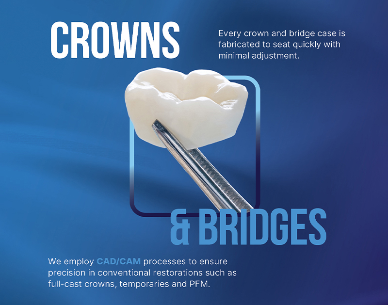 Keating Dental Lab Crowns and Bridges email